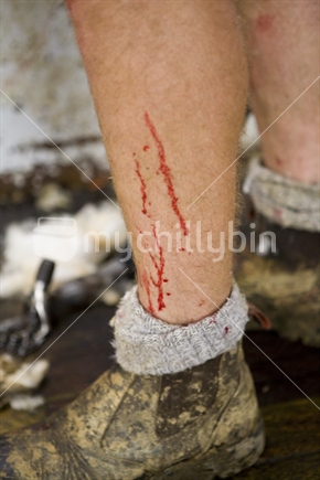 Shearing blood on farmers leg