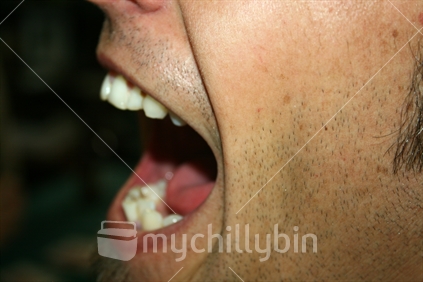 Extreme closeup of mans stubbled face, with wide open mouth.